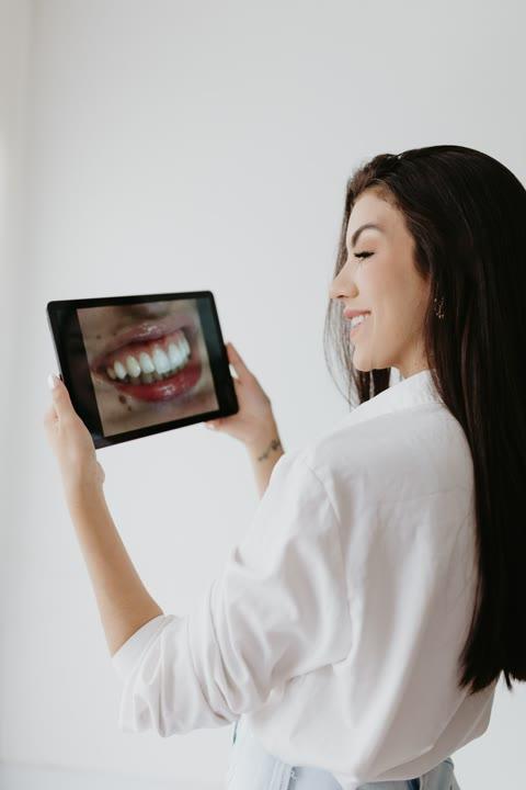 Diseño de sonrisa